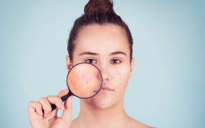 毛孔粗大救星【麗珠蘭Skin Booster】！選沐西醫美正版授權療程！