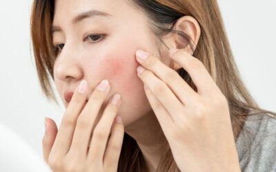 換季皮膚好敏感！沐西3分鐘帶你看換季困擾該怎麼改善