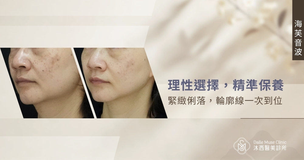 緊緻俐落，輪廓線一次到位——『海芙音波』