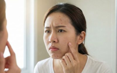 粉刺長不停、無法徹底清潔怎麼辦？沐西醫美用Geneo X 氧氣嫩膚儀幫你維持日常深度保養